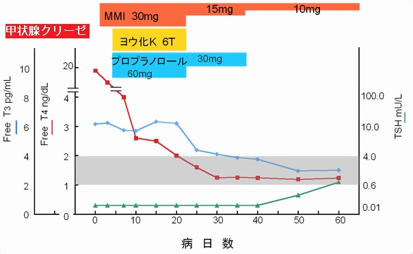 甲状腺クリーゼの治療[甲状腺 橋本病 バセドウ病 甲状腺超音波エコー検査 長崎甲状腺クリニック大阪]