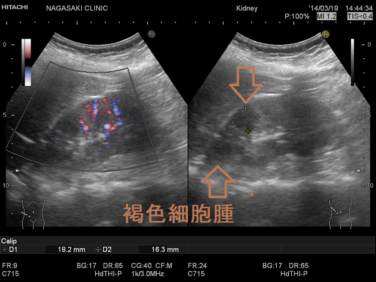 注文商品 内分泌腫瘍 甲状腺，副腎 医学・薬学 PRIMAVARA