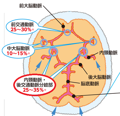 バセドウ病眼症(甲状腺眼症)と鑑別(視神経炎・眼神経障害)[橋本病 長崎甲状腺クリニック大阪]