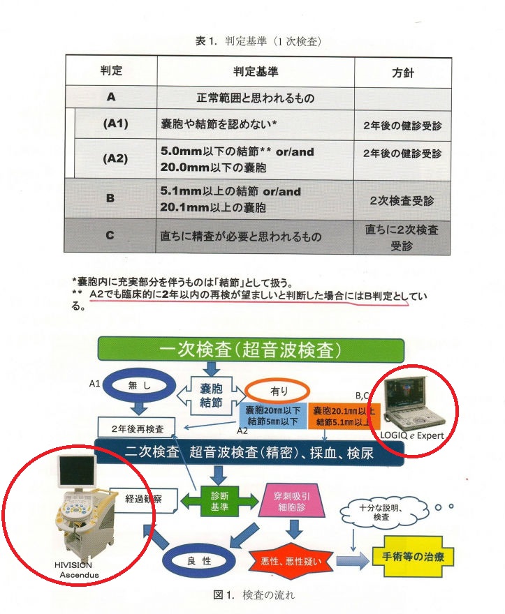 福島原発事故と甲状腺検診、県民健康調査、ヨード131内部被曝[橋本病 