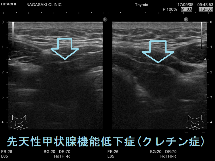 遺伝性甲状腺疾患のすべて [本]の通販はau PAY マーケット - ぐるぐる王国 au PAY マーケット店 - 臨床医学一般