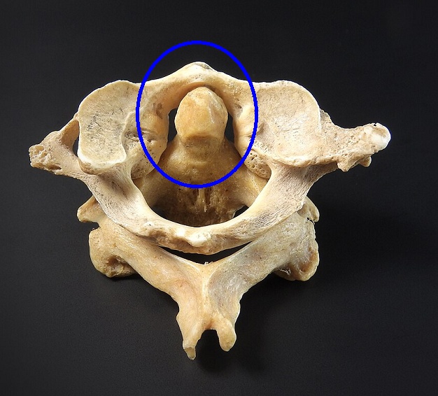 環推 軸推 歯突起 環推 軸推 歯突起
