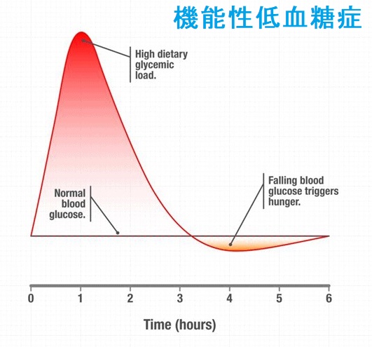 機能性低血糖症 機能性低血糖症