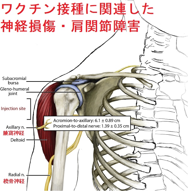 ワクチン接種に関連した神経損傷・肩関節障害 ワクチン接種に関連した神経損傷・肩関節障害