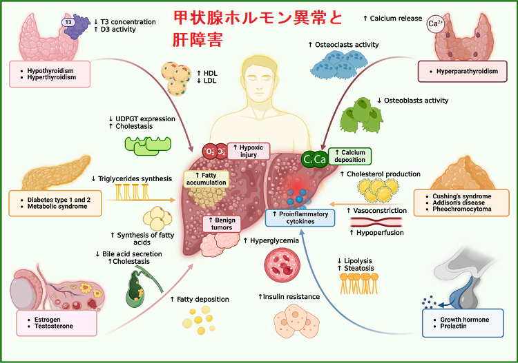 甲状腺ホルモン異常と肝障害 甲状腺ホルモン異常と肝障害